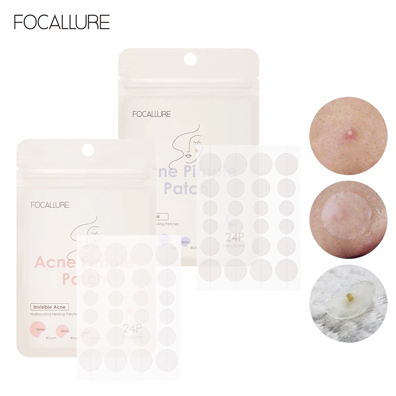 FOCALLURE Acne Pimple patch
