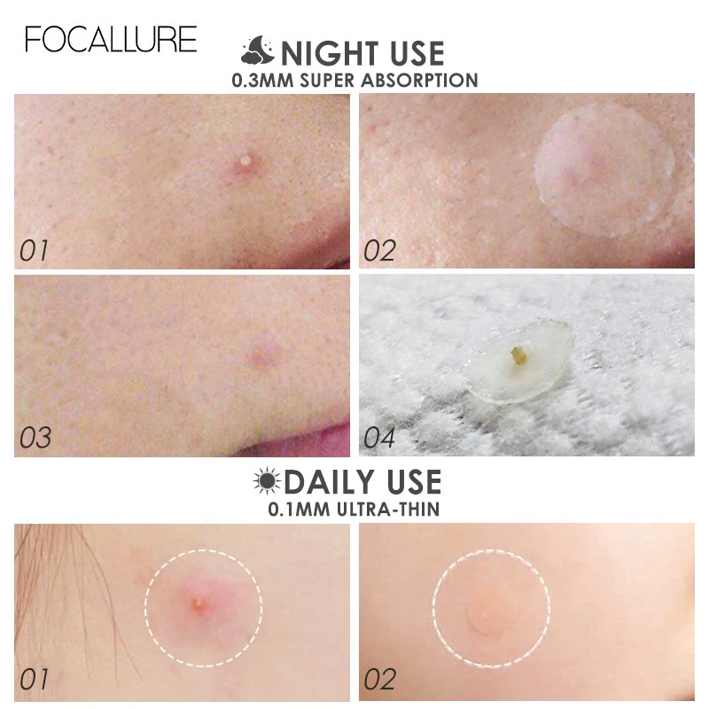 FOCALLURE Acne Pimple patch